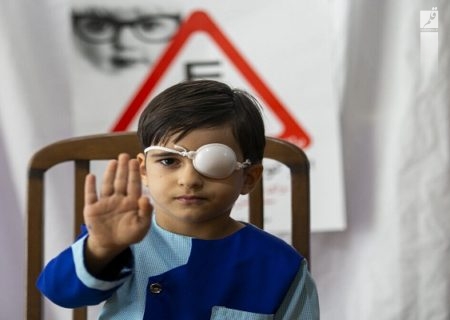آغاز غربالگری پیشگیری از تنبلی چشم کودکان در خوزستان